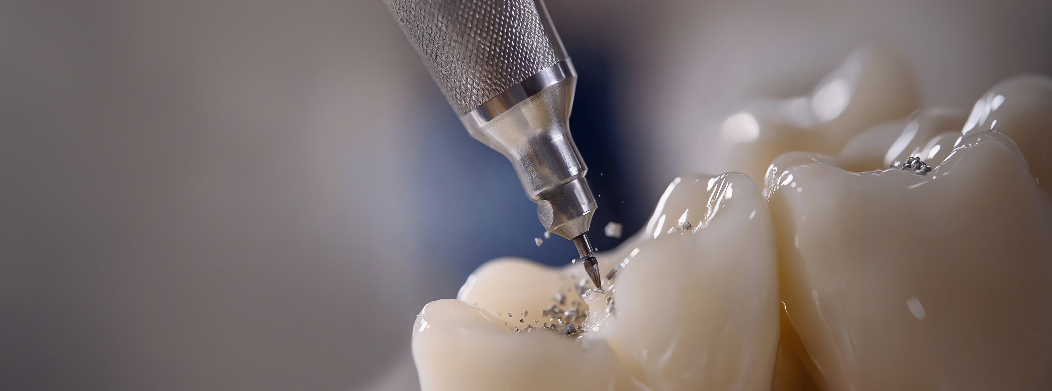 Precision dental technology